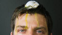 josh-tetrick-egg-on-face josh-tetrick-egg-on-face