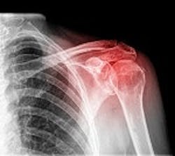 1660254309329 Jointhealth Small 1660254309329 Jointhealth Small