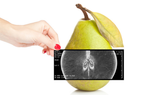 1660317509537 Pearxray