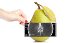 1660317509537 Pearxray 1660317509537 Pearxray