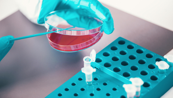 The ABCs of Microbial Testing Food Processing