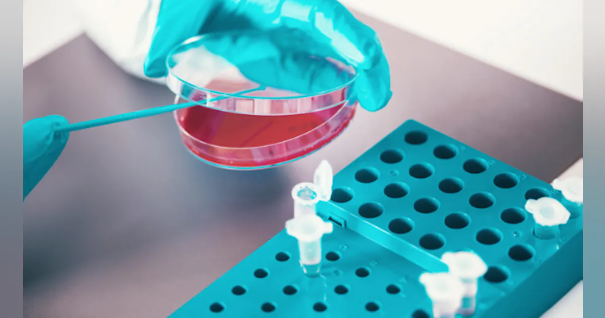 The ABCs of Microbial Testing | Food Processing