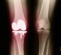 1660319308569 Resizedimage350317bonehealth 1660319308569 Resizedimage350317bonehealth