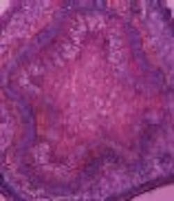 1660602457000 Antioxidantthumbnail 1 1660602457000 Antioxidantthumbnail 1