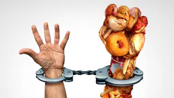 Junkfood Cuffs 636ec3f867f4c Junkfood Cuffs 636ec3f867f4c
