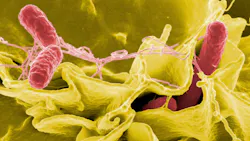 'Salmonella Bacteria' 'Salmonella Bacteria'